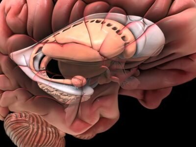 Brain damage is an injury that causes the destruction or deterioration of brain cells. 3D illustration